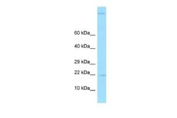 Gastrokine 2 Rabbit anti-Human, Polyclonal, Novus Biologicals 0.1ml; Unconjugated:Antibodies,
